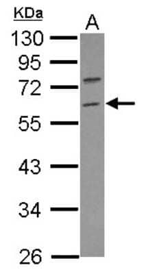 Western Blot: RNF36 Antibody [NBP2-20188]