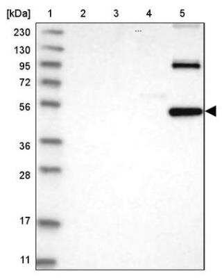 Western Blot: RNF36 Antibody [NBP2-42073]