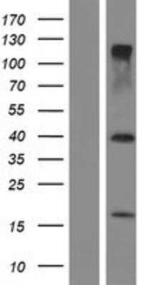 Western Blot: RNF36 Overexpression Lysate [NBP2-05761]