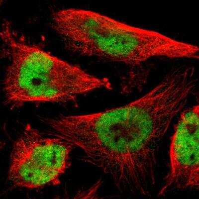 Immunocytochemistry/ Immunofluorescence: RNF38 Antibody [NBP1-86453]