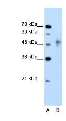 Western Blot: RNF38 Antibody [NBP1-53108]