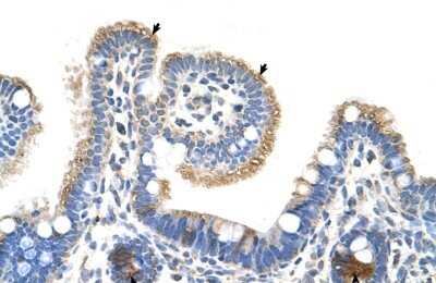 Immunohistochemistry-Paraffin: RNF39 Antibody [NBP1-55282]