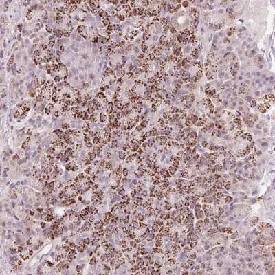 Immunohistochemistry-Paraffin: RNF39 Antibody [NBP2-33479]