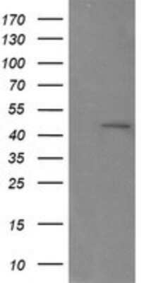 Western Blot: RNF39 Antibody (OTI5E10)Azide and BSA Free [NBP2-73927]