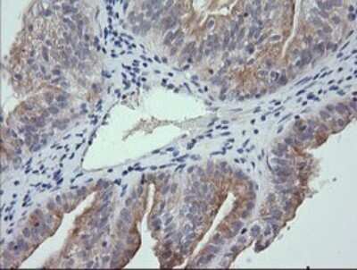 Immunohistochemistry: RNF39 Antibody (OTI5E10) [NBP2-45962]