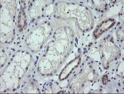 Immunohistochemistry: RNF39 Antibody (OTI5E10) [NBP2-45962]
