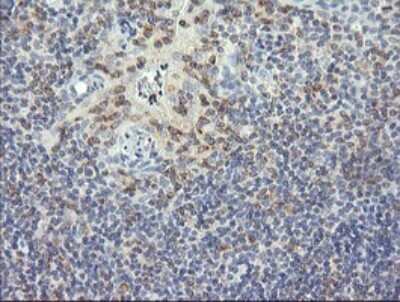 Immunohistochemistry: RNF39 Antibody (OTI5E10) [NBP2-45962]