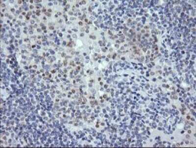 Immunohistochemistry: RNF39 Antibody (OTI5E10) [NBP2-45962]