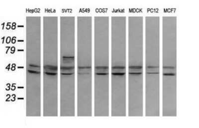 Western Blot: RNF39 Antibody (OTI5E10) [NBP2-45962]