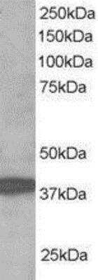 Western Blot: RNF39 Antibody [NB300-842]