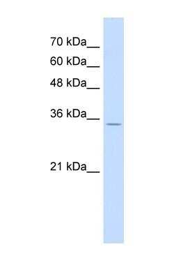 Western Blot: RNF39 Antibody [NBP1-55282]