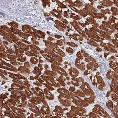 Immunohistochemistry-Paraffin: RNF4 Antibody [NBP2-13243]