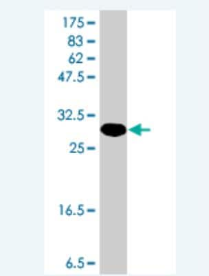 Western Blot: RNF4 Antibody [H00006047-A01]