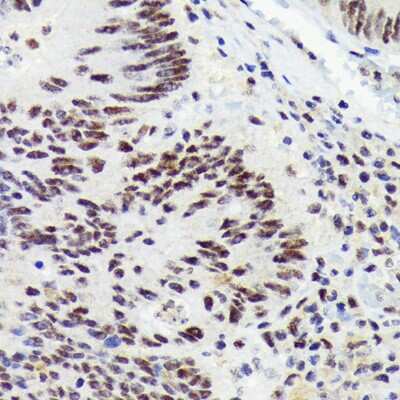 Immunohistochemistry-Paraffin: RNF40 Antibody (8I7R5) [NBP3-16834]