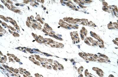 Immunohistochemistry: RNF40 Antibody [NBP1-53086]