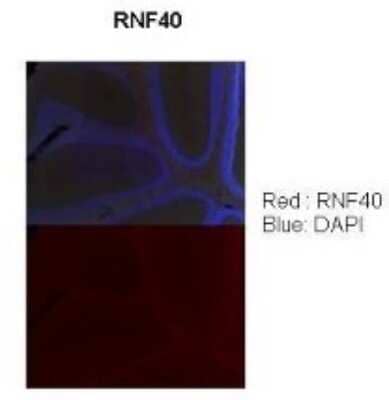 Immunohistochemistry: RNF40 Antibody [NBP1-53086]