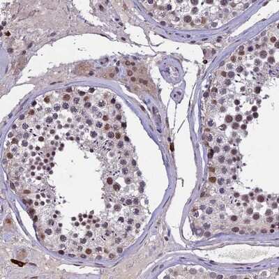 Immunohistochemistry-Paraffin: RNF40 Antibody [NBP1-88356]