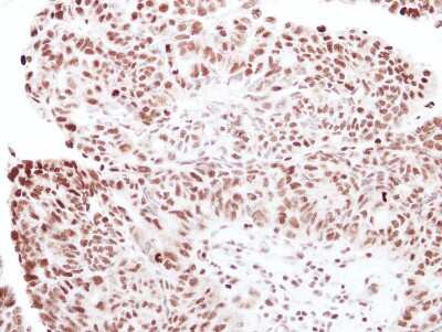 Immunohistochemistry-Paraffin: RNF40 Antibody [NBP2-20189]