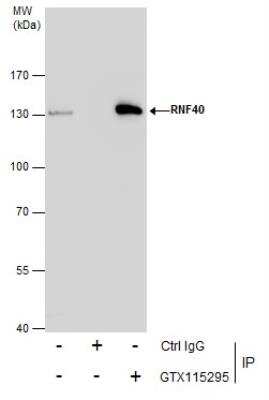 Immunoprecipitation: RNF40 Antibody [NBP2-20189]