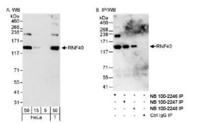 Western Blot: RNF40 Antibody [NB100-2247]