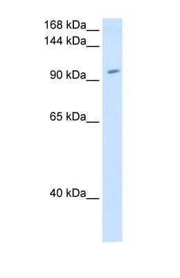 Western Blot: RNF40 Antibody [NBP1-53086]