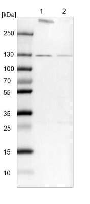 Western Blot: RNF40 Antibody [NBP1-88356]