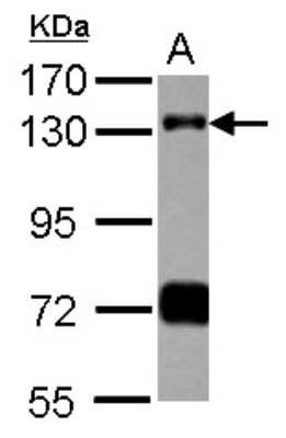 Western Blot: RNF40 Antibody [NBP2-20190]