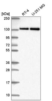 Western Blot: RNF40 Antibody [NBP2-54968]