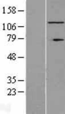 Western Blot: RNF40 Overexpression Lysate [NBL1-15455]