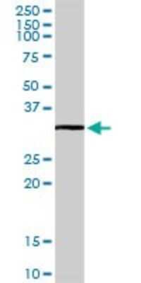 Western Blot: RNF41 Antibody [H00010193-D01P]