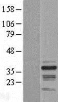 Western Blot: RNF41 Overexpression Lysate [NBL1-15456]