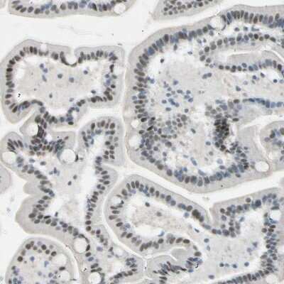 Immunohistochemistry-Paraffin: RNF43 Antibody [NBP1-85018]