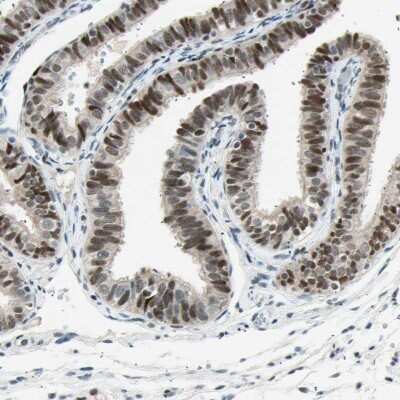 Immunohistochemistry-Paraffin: RNF43 Antibody [NBP1-85018]