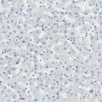 Immunohistochemistry-Paraffin: RNF43 Antibody [NBP1-85018]