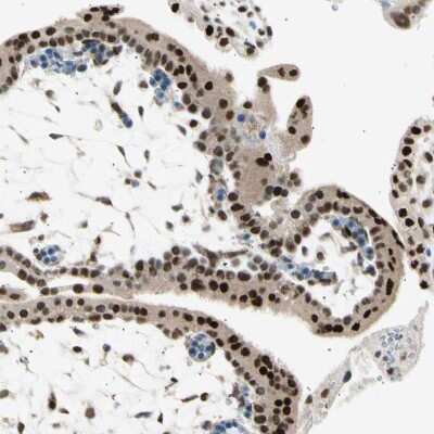 Immunohistochemistry-Paraffin: RNF43 Antibody [NBP1-85018]