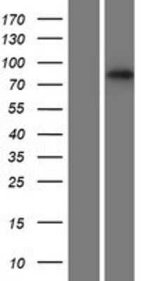 Western Blot: RNF43 Overexpression Lysate [NBP2-06928]