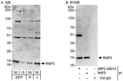 Immunoprecipitation: RNF5 Antibody [NBP2-04014]