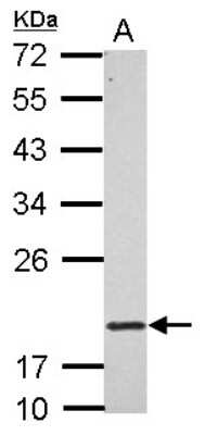 Western Blot: RNF5 Antibody [NBP2-20192]