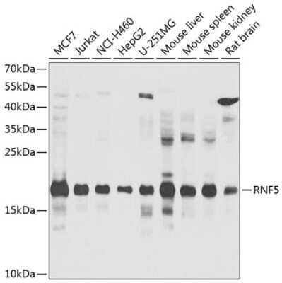 Western Blot: RNF5 AntibodyBSA Free [NBP2-94913]