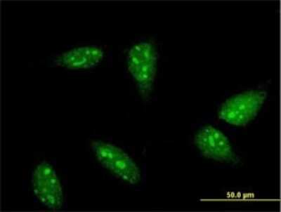 Immunocytochemistry/ Immunofluorescence: RNF6 Antibody (3B1) [H00006049-M01]