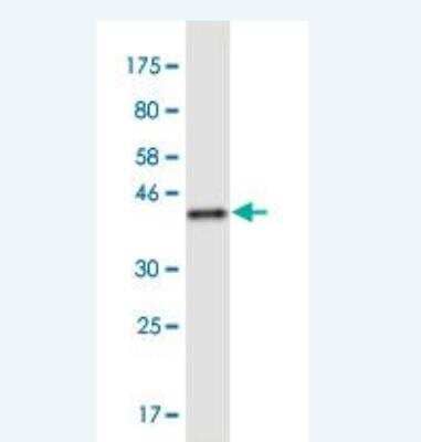 Western Blot: RNF6 Antibody (6D5) [H00006049-M02]