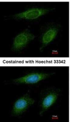 Immunocytochemistry/ Immunofluorescence: RNF6 Antibody [NBP1-31039]