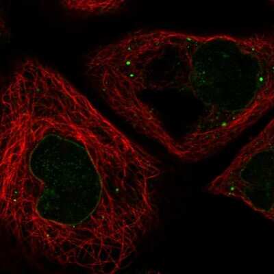 Immunocytochemistry/ Immunofluorescence: RNF6 Antibody [NBP1-84107]