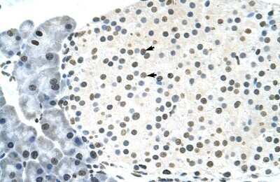Immunohistochemistry-Paraffin: RNF6 Antibody [NBP1-80251]
