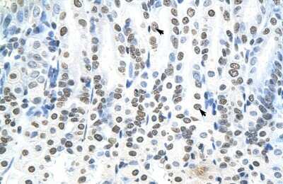 Immunohistochemistry-Paraffin: RNF6 Antibody [NBP1-80251]