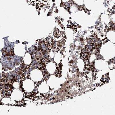 Immunohistochemistry-Paraffin: RNF6 Antibody [NBP1-84107]