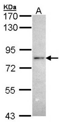 Western Blot: RNF6 Antibody [NBP1-31039]