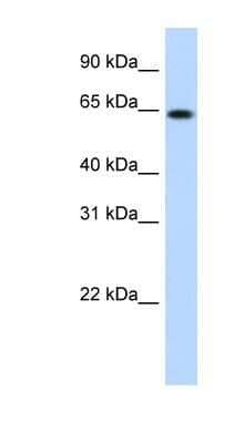 Western Blot: RNF6 Antibody [NBP1-80251]