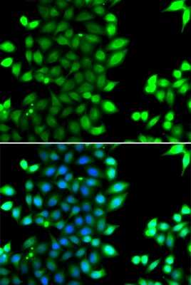 Immunocytochemistry/ Immunofluorescence: RNF7 Antibody - BSA Free [NBP3-04412]