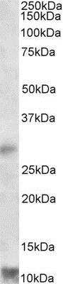 Western Blot: RNF7 Antibody [NBP1-46159]